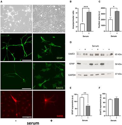 A convenient model of serum-induced reactivity of human astrocytes to investigate astrocyte-derived extracellular vesicles